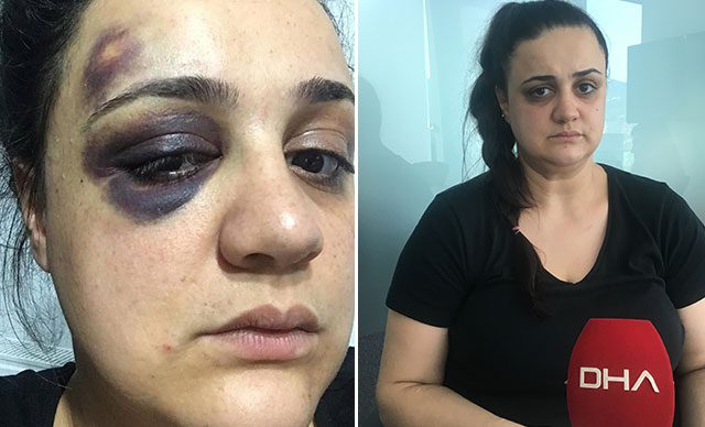 سجن وغرامة مالية لرجل تركي عنف زوجته
