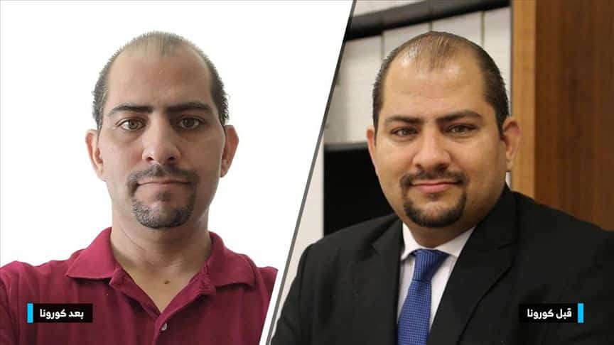 شفاء أول مريض عربي في تركيا من كورونا