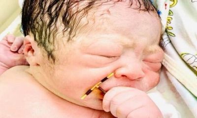 طفل يولد حاملا وسيلة منع حمل أمه بين يديه (صور)