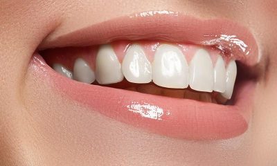 8 طرق طبيعية لتبييض أسنانك في المنزل