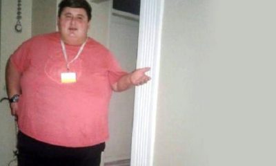 شاب تركي يفقد 212 كيلوغراما من وزنه في 6 أشهر... والسبب! (صور)