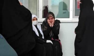 حادثة مروعة.. إصابة امرأة بجروح خطيرة بعد وقوعها في "التنور" (فيديو)