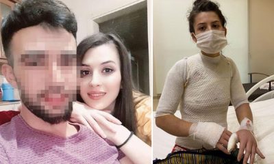 بعد سنوات من الانفصال، تركي يسكب الماء الساخن على زوجته وطفلته والسبب!