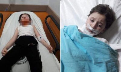 كلاب ضالة تهاجم طفلاً في ولاية كوجالي