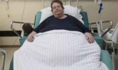 أغرب خطأ طبي.. دخل لإجراء عملية في القلب فأجروا له ولادة قيصرية