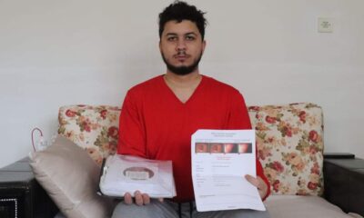 تسببت في حيرة الأطباء.. شاب تركي لم يشعر بالجوع منذ أكثر عام