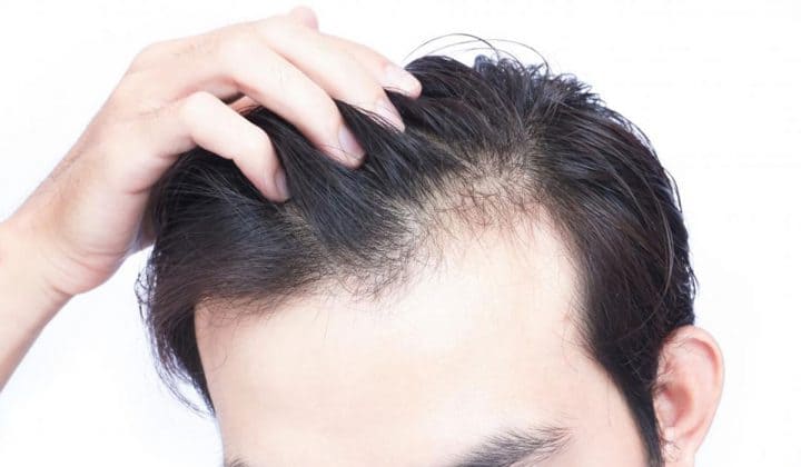 أفضل مراكز زراعة الشعر في تركيا 2023