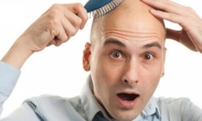 تحذير للرجال.. مشروبات الطاقة والمياه الغازية تؤدي للصلع