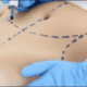 نزفت 8 ساعات.. شفط دهون بمركز تجميل يهز الأردن