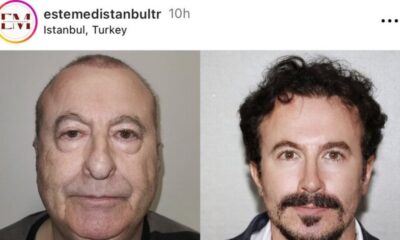 بالفيديو.. صاحب صورة عملية التجميل "المعجزة" يكشف الحقيقة