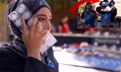 توب شيف تركيا.. متسابقة تسكب الزيت الساخن على وجهها!