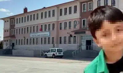 طفل يواجه الموت بسبب حادثة تنمر في مدرسته بتركيا