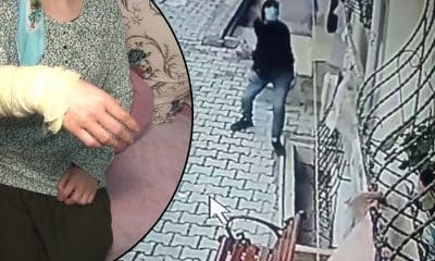 هجوم مروع بالأسيد على عائلة في إسطنبول.. تفاصيل