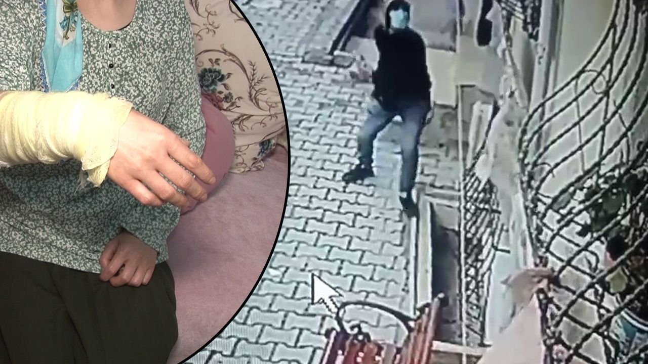 هجوم مروع بالأسيد على عائلة في إسطنبول.. تفاصيل