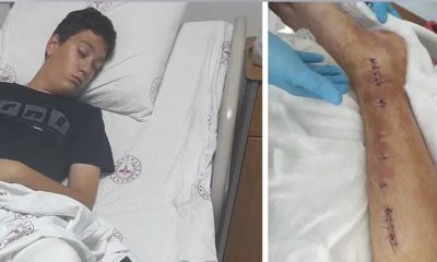 طالب يتعرض للتنمر في تركيا، والمدرسة تلوم عائلته