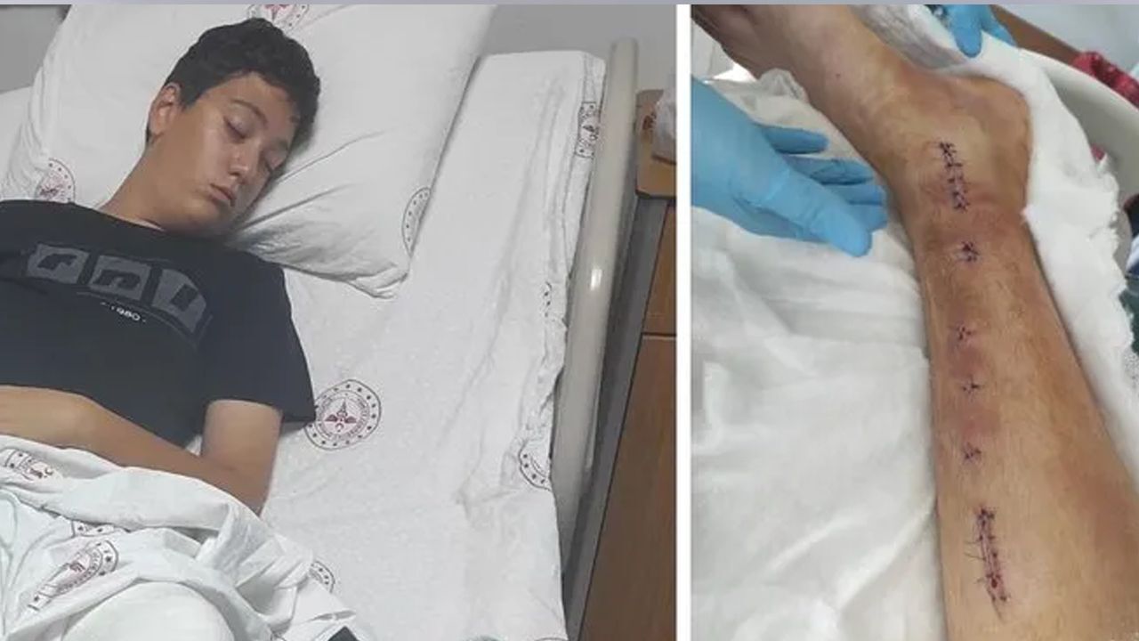 طالب يتعرض للتنمر في تركيا، والمدرسة تلوم عائلته