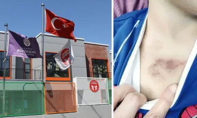 اتهامات خطيرة داخل حضانة تابعة لبلدية إسطنبول الكبرى.. وتحقيق رسمي يكشف الحقيقة